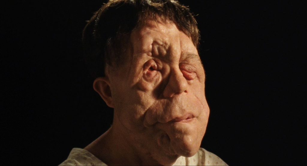 Adam Pearson in a scene from <i>Chained for Life</i>, courtesy Kino Lorber