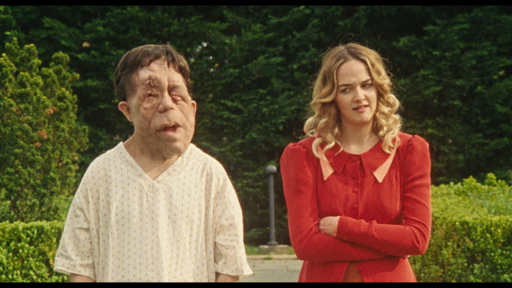 Adam Pearson and Jess Weixler in a scene from <i>Chained for Life</i>, courtesy Kino Lorber