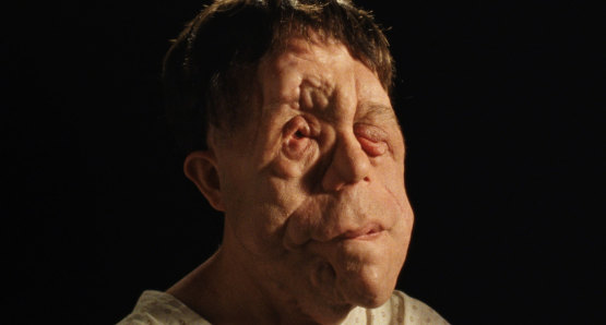 Adam Pearson in a scene from <i>Chained for Life</i>, courtesy Kino Lorber